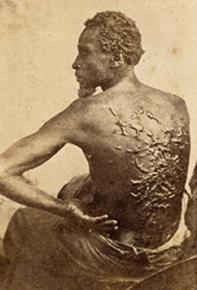 A slave with scars from being whipped